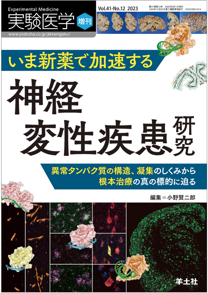 実験医学増刊号に総説を報告しました – 滋賀医科大学ミスフォールドタンパク質関連疾患治療学講座